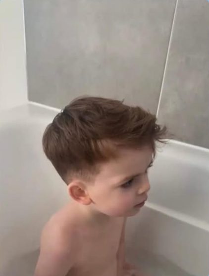 The same boy with clear skin in the bath after treatment
